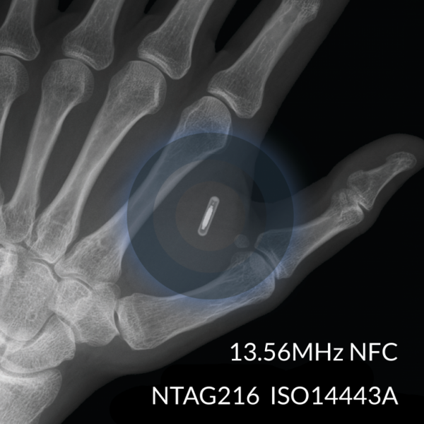 Dangerous Things Multipass NFC-Implantat xNT
